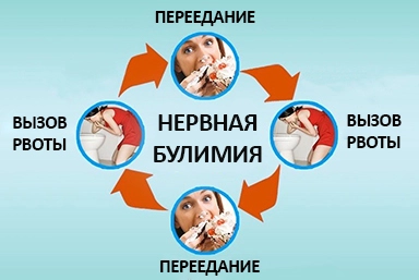 Лечение булимии в городе Сегежа
